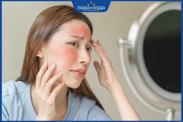 Lăn kim trị nám có hiệu quả không? Quy trình và chi phí thực hiện 4 đối tượng không nên lăn kim trị nám