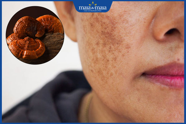 hiệu quả chữa nám bằng nấm linh chi