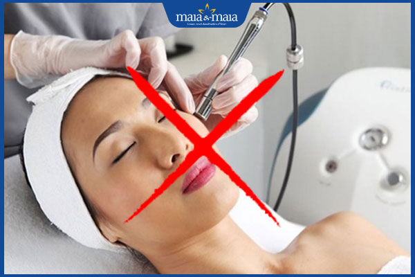 6 sai lầm trong điều trị rám má khiến da ngày càng sạm hơn 4 lạm dụng laser