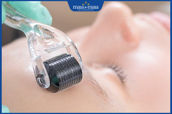 Nám da có tự hết không? Làm sao để điều trị nám hiệu quả? 3 lăn kim loại bỏ nám da