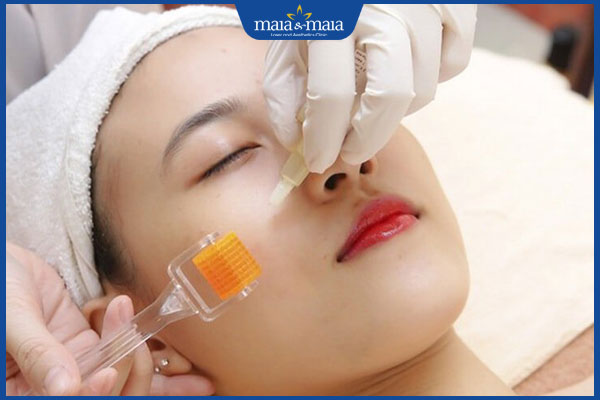 lăn kim tế bào gốc