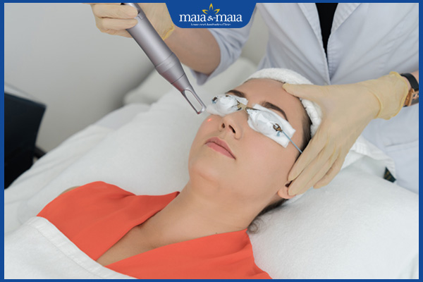 Gợi ý các công nghệ trị nám phổ biến, mang lại hiệu quả cao 2 loại bỏ nám bằng công nghệ hiện đại