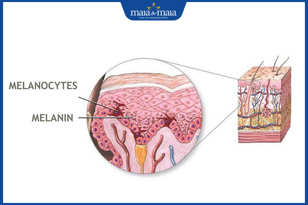 Cơ chế hình thành nám thế nào? Gợi ý điều trị hiệu quả 4 lý do hiểu cơ chế hình thành nám