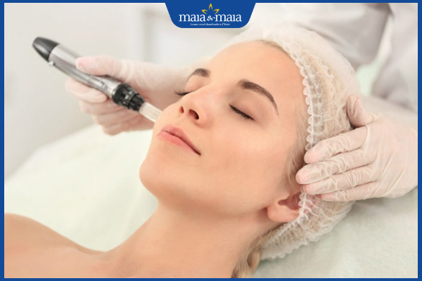 Bắn tàn nhang có hết không? Làm sao để đạt hiệu quả tốt nhất? 2 mức độ hiệu quả bắn tàn nhang