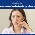 nám bẩm sinh