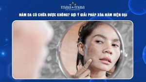 Nám da có chữa được không? Gợi ý giải pháp xóa nám hiện đại 62 nám da có chữa được không