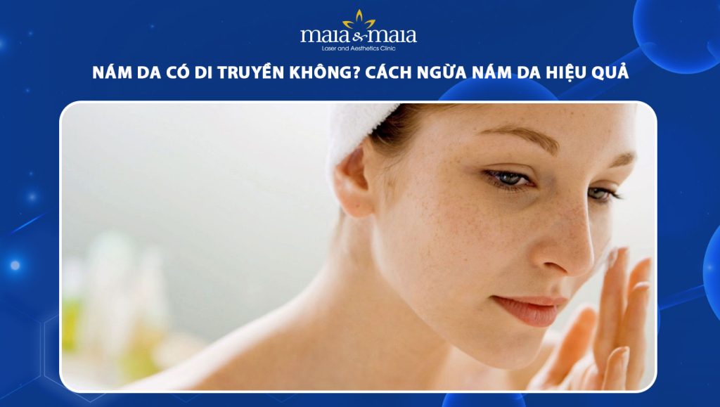 nám da có di truyền không