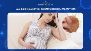 Nám da khi mang thai do đâu? Cách điều trị cải thiện 62 nám da khi mang thai