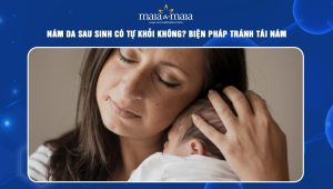 Nám da sau sinh có tự khỏi không? Biện pháp tránh tái nám  97 nám da sau sinh