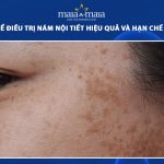 nám nội tiết