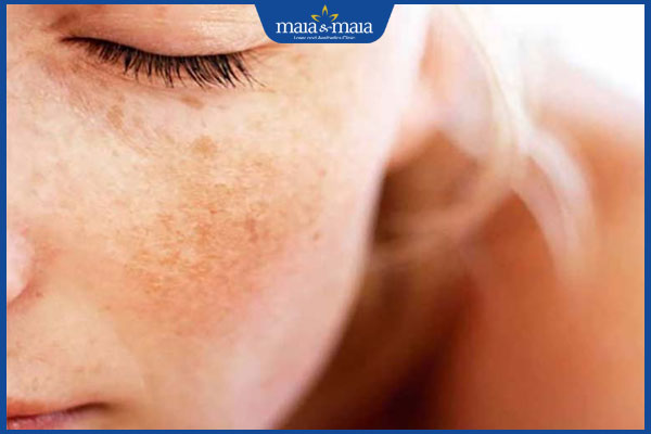 nám nông không tự hết