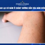 nám ở chân