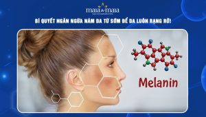 ngăn ngừa nám da