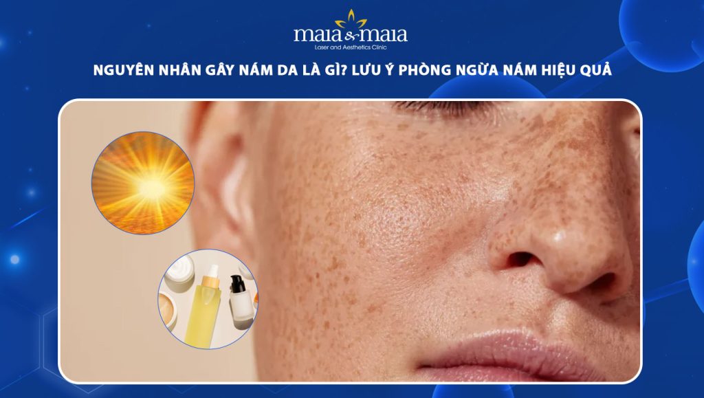 nguyên nhân gây nám da