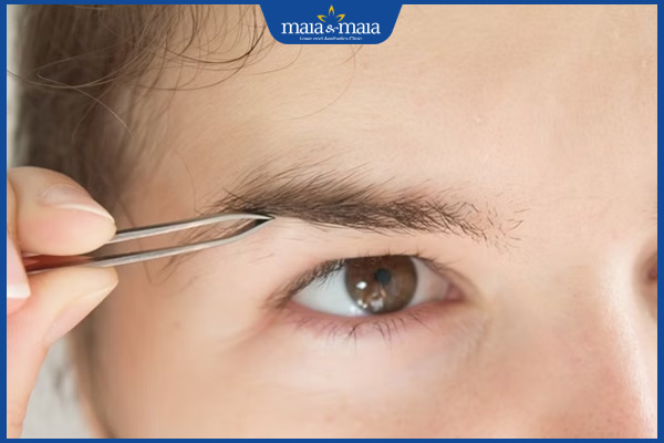 Nhổ lông mày bị sụp mí phải không? Địa chỉ triệt lông mày an toàn 2 nhổ lông mày sụp mí