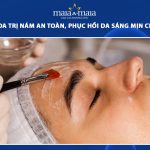 peel da trị nám