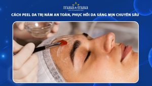 Peel da trị nám an toàn, phục hồi da sáng mịn chuyên sâu 60 peel da trị nám