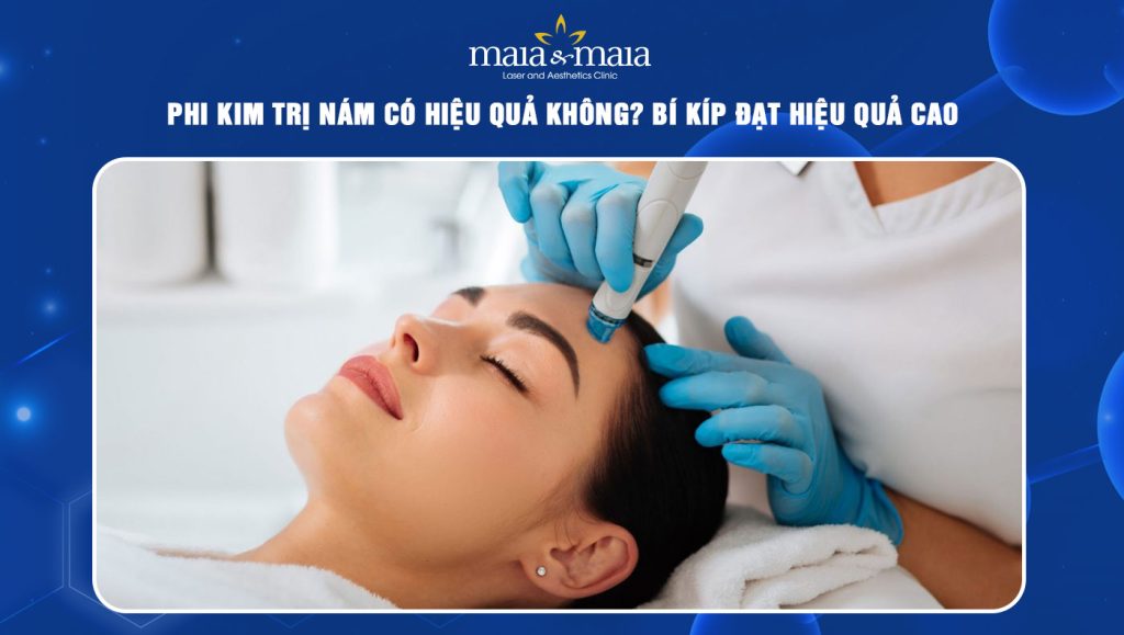Phi kim trị nám có hiệu quả không? Bí kíp đạt hiệu quả cao 1 phi kim trị nám