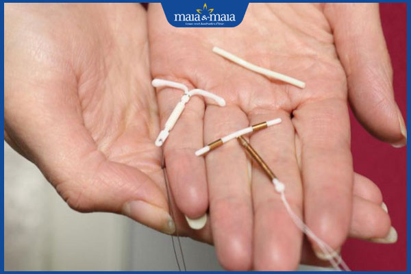 Cấy que tránh thai có bị nám da không? Khi nào cần tháo bỏ?  2 que tránh thai