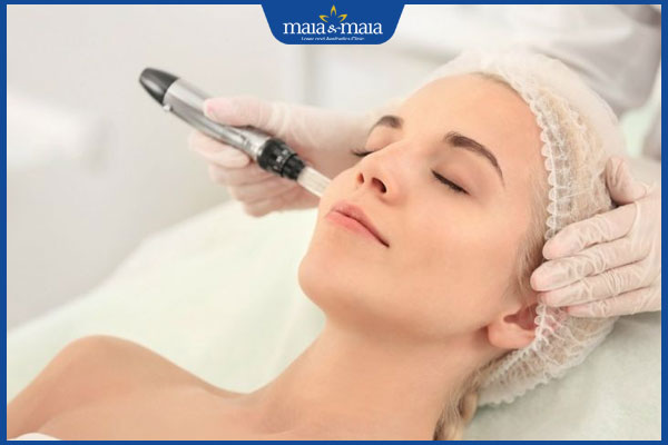 Phi kim trị nám có hiệu quả không? Bí kíp đạt hiệu quả cao 4 quy trình phi kim xóa nám