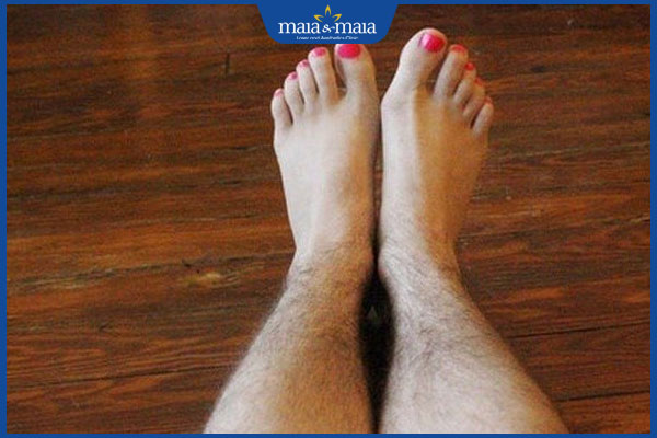 rậm lông chân ở nữ