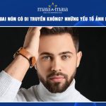 râu quai nón có di truyền không