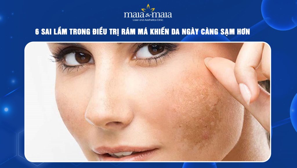 6 sai lầm trong điều trị rám má khiến da ngày càng sạm hơn 1 sai lầm trong điều trị rám má