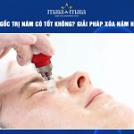 tế bào gốc trị nám