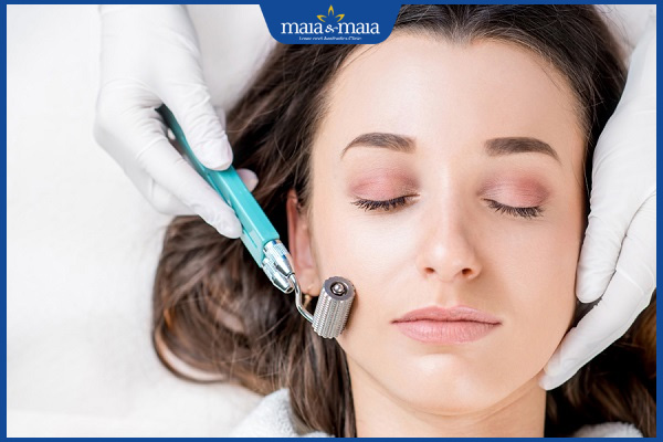 Lăn kim trị nám có hiệu quả không? Quy trình và chi phí thực hiện 2 tìm hiểu lăn kim trị nám