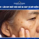 trị nám 1 lần duy nhất