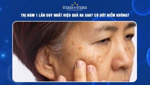 trị nám 1 lần duy nhất