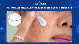 Trị nám bằng Azelaic Acid có hiệu quả không? Lưu ý khi thực hiện 64 trị nám bằng azelaic acid