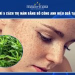 trị nám bằng bồ công anh