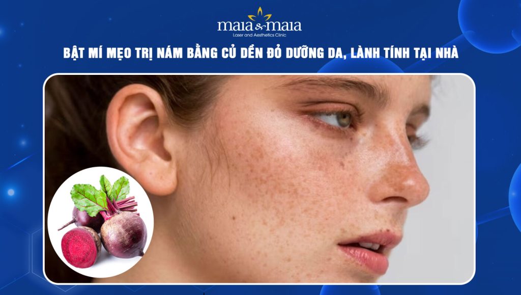 Bật mí mẹo trị nám bằng củ dền đỏ dưỡng da, lành tính tại nhà 1 trị nám bằng củ dền đỏ