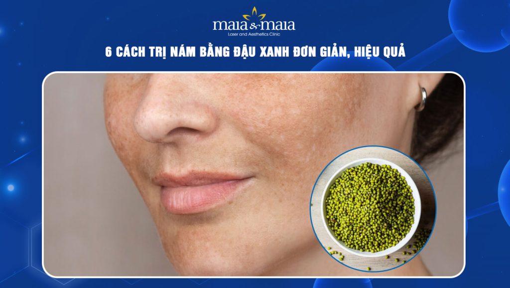 trị nám bằng đậu xanh