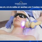 trị nám bằng ipl