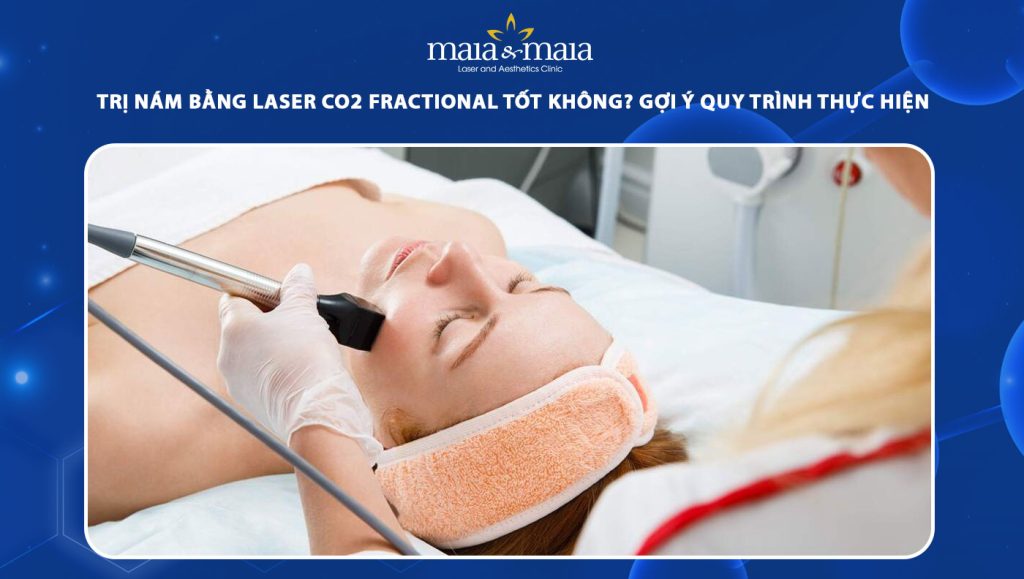 trị nám bằng laser co2 fractional