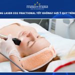trị nám bằng laser co2 fractional