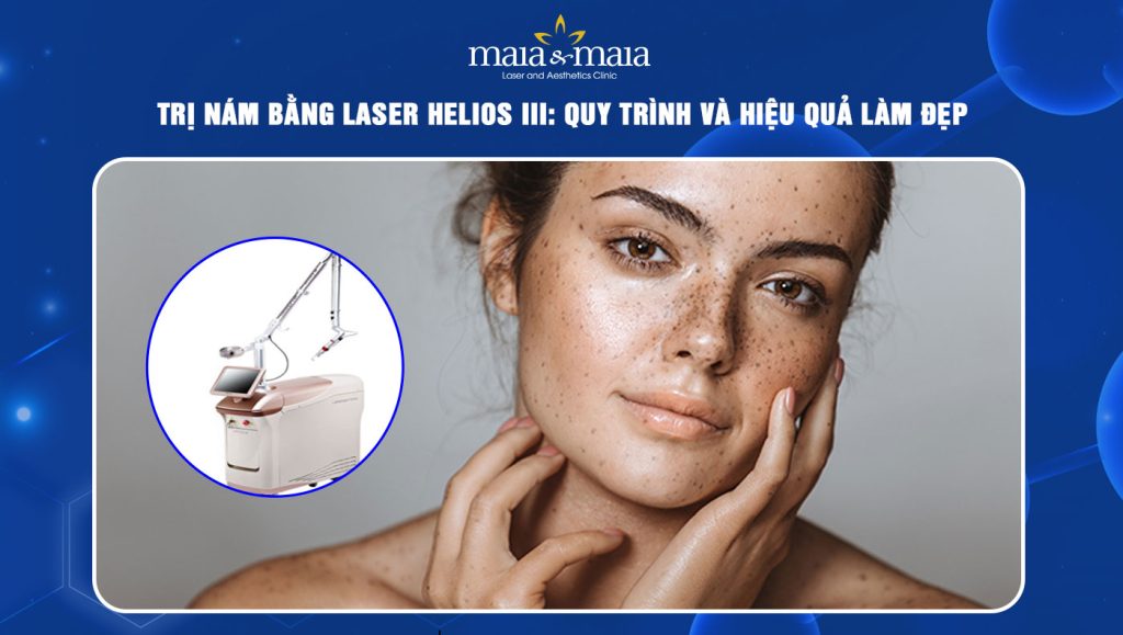 Trị nám bằng Laser Helios III: Quy trình và hiệu quả làm đẹp 1 trị nám bằng laser helios iii