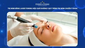 Trị nám bằng Laser Toning hiệu quả không? Quy trình trị nám chuẩn y khoa 78 trị nám bằng laser toning