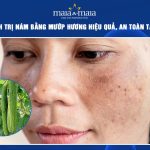 trị nám bằng mướp hương