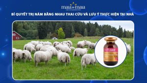 Bí quyết trị nám bằng nhau thai cừu và lưu ý thực hiện tại nhà 65 trị nám bằng nhau thai cừu