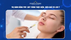 Trị nám bằng PRP: Quy trình thực hiện, hiệu quả và lưu ý  16 trị nám bằng prp