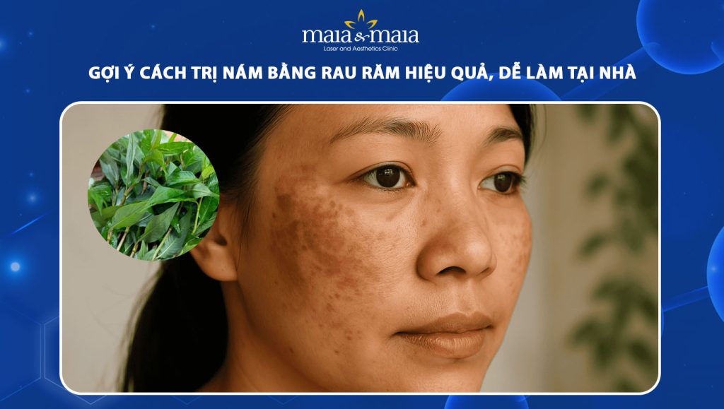 trị nám bằng rau răm