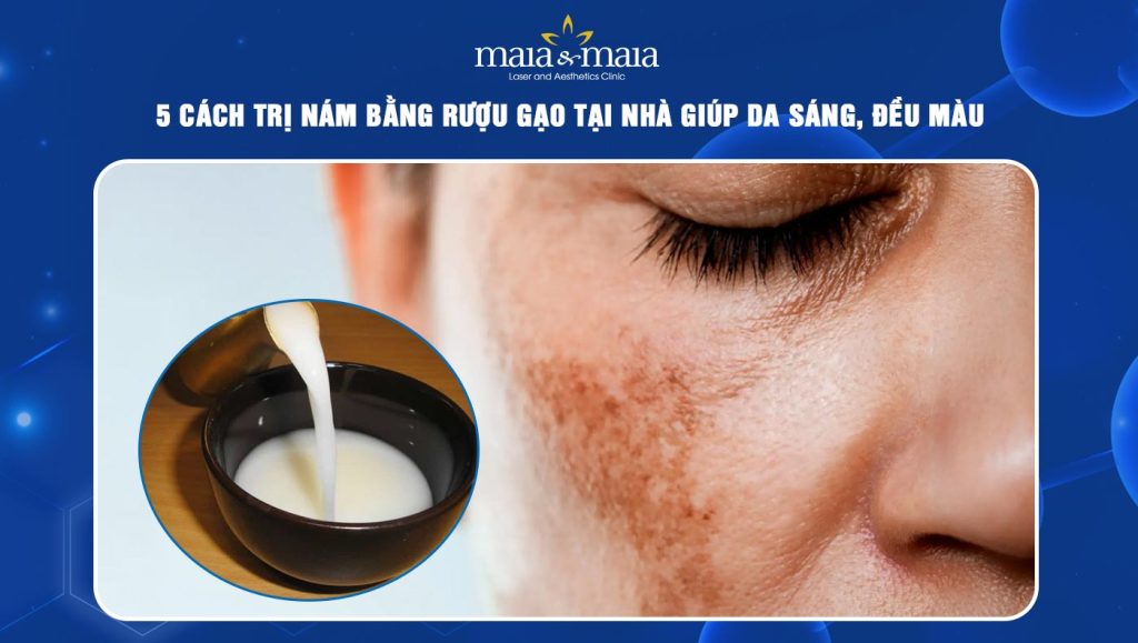 trị nám bằng rượu gạo