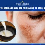 trị nám bằng rượu gạo
