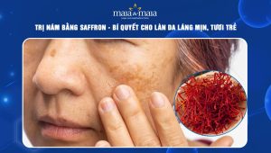 Trị nám bằng saffron: Bí quyết cho làn da láng mịn, tươi trẻ 88 trị nám bằng saffron