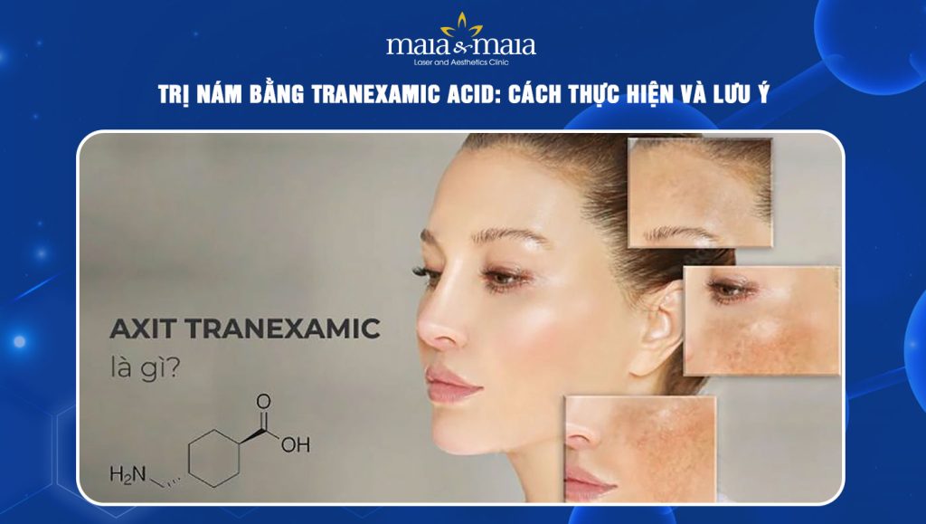 trị nám bằng tranexamic acid