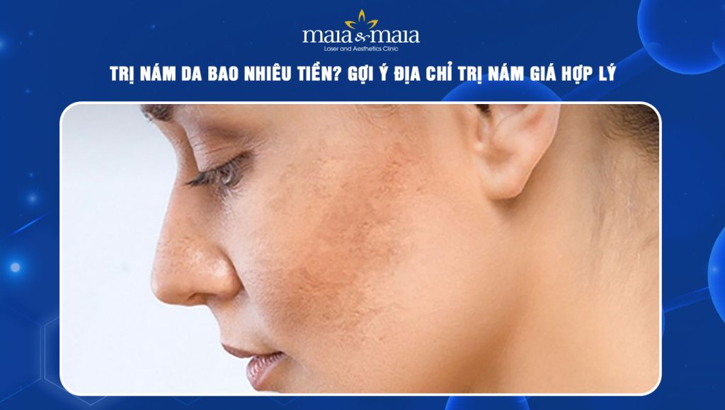 trị nám da bao nhiêu tiền