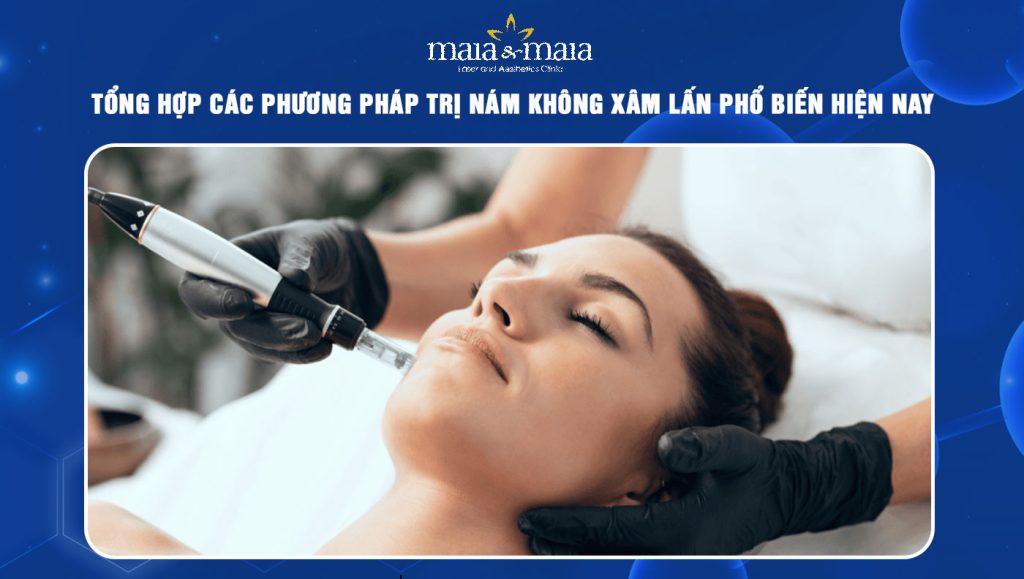 Tổng hợp các phương pháp trị nám không xâm lấn phổ biến hiện nay 1 trị nám không xâm lấn